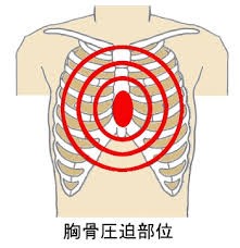 CO中毒チラシ